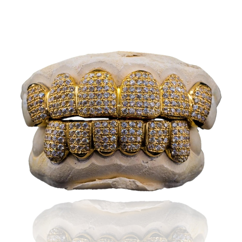 VVS Diamond Grillz (Straight Set) - 10K Gold